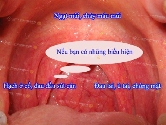 8fb82c26-6220-4f28-827a-e4bae44477f9.png
